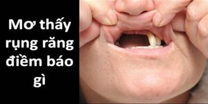 Vì sao nằm mơ rụng răng? 