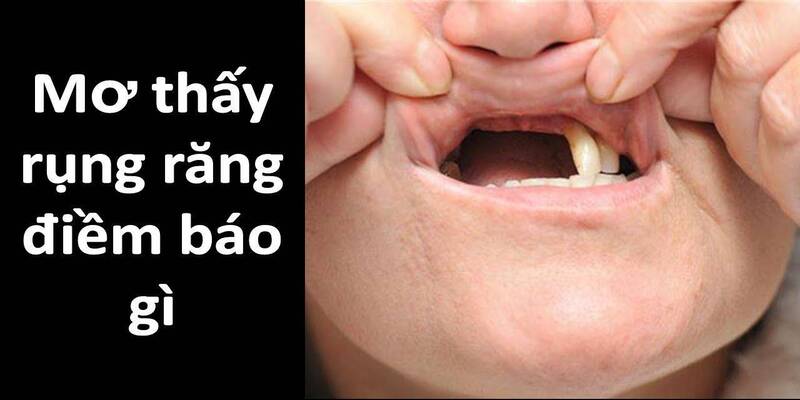 Vì sao nằm mơ rụng răng? 